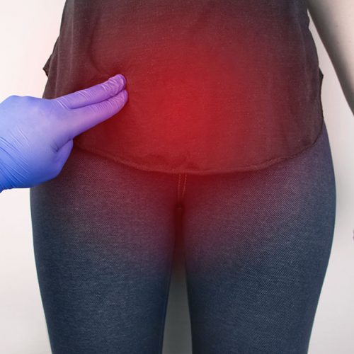 Wanita Perlu Tahu Apa Itu Fibroid Rahim